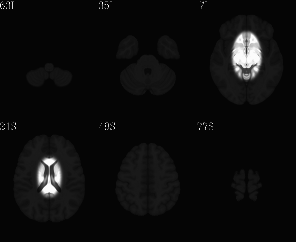 ../../_images/IMG_mni_icbm152_t1_tal_nlin_sym_09a_MSKD_ACPCE_wtell.axi.png