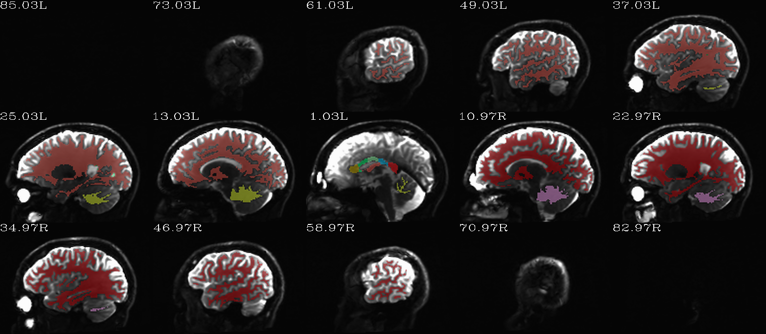 ../../_images/indt__qc_aparc.a2009s%2Baseg_REN_wmat.sag.png