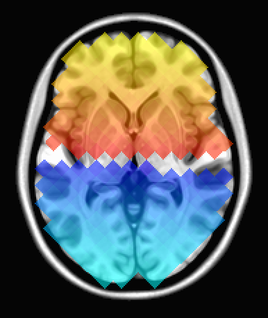 ../_images/mm_cbar_Spectrum%3Ayellow_to_cyan%2Bgap.axi.png