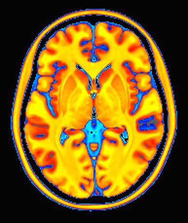 ../_images/tt_cbar_Spectrum%3Ayellow_to_cyan%2Bgap.axi.png